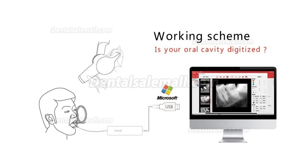 Runyes DR730 Dental Digital X-ray Sensor Intraoral Sensor Image System